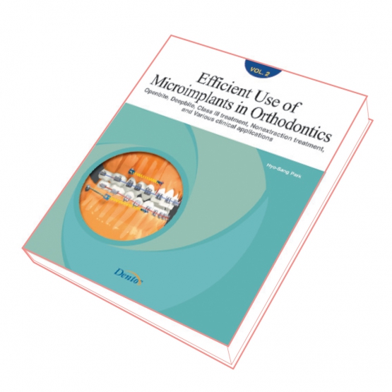 Efficient Use of Microimplants in Orthognathics